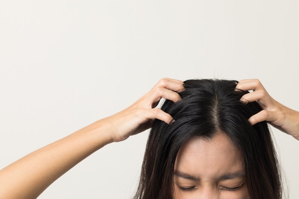 itchy scalp