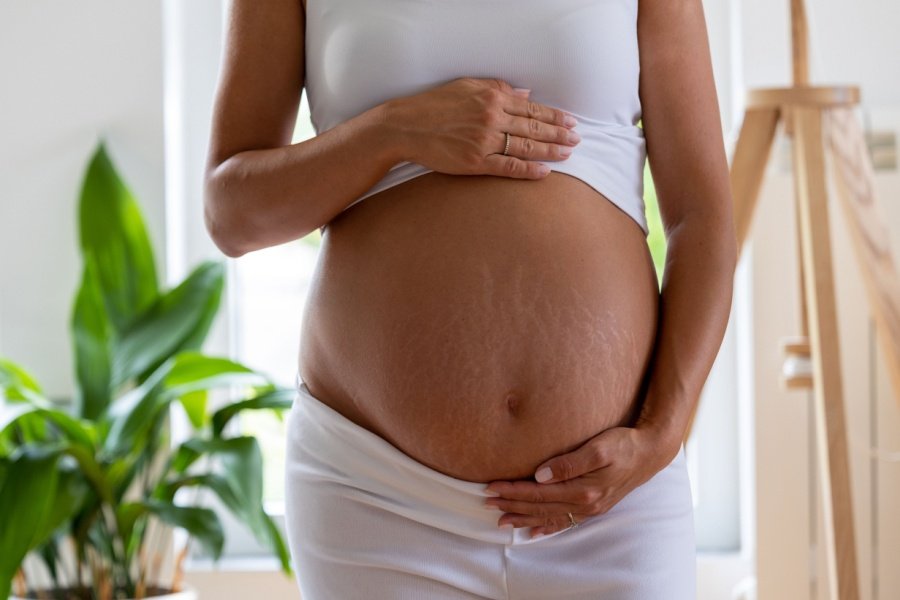 stretch marks on belly of pregnant woman