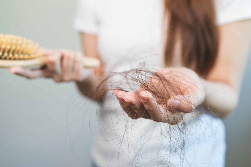 a woman with hair loss