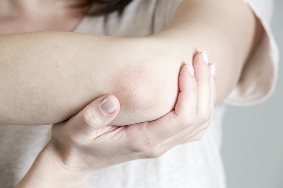 person with dry skin