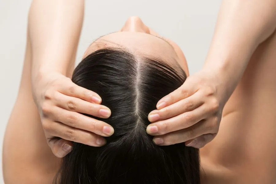 woman's scalp