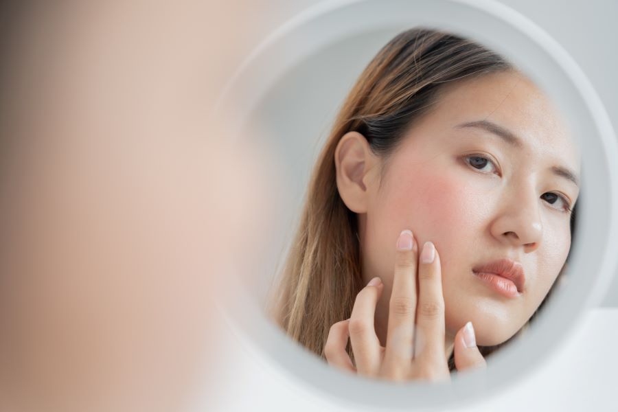 woman with sensitive skin