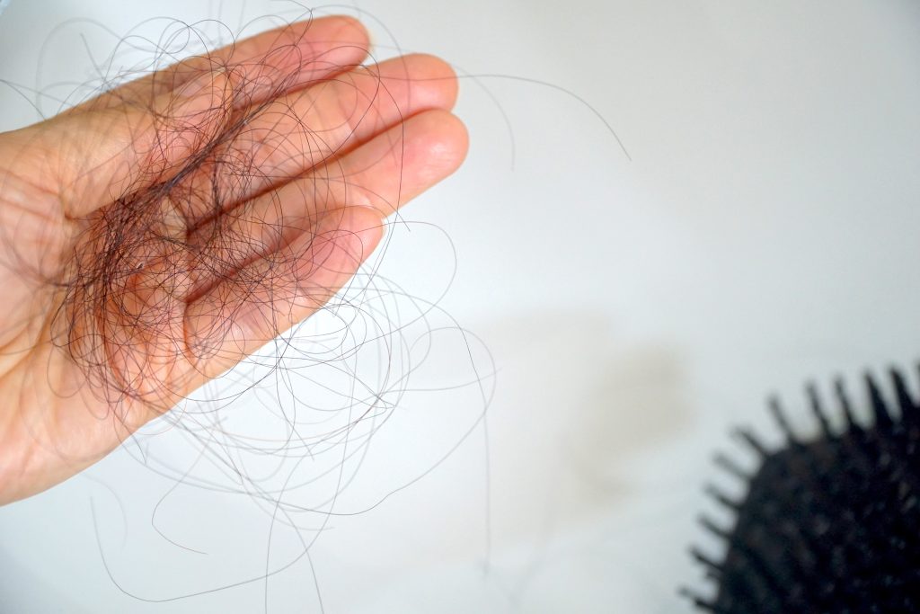 a woman with hair loss